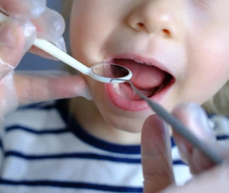 دكاترة اسنان اطفال